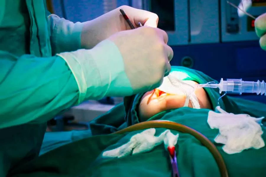 Mutirão de Cirurgias para correção de fissura lábio-palatal é realizado no HMTF