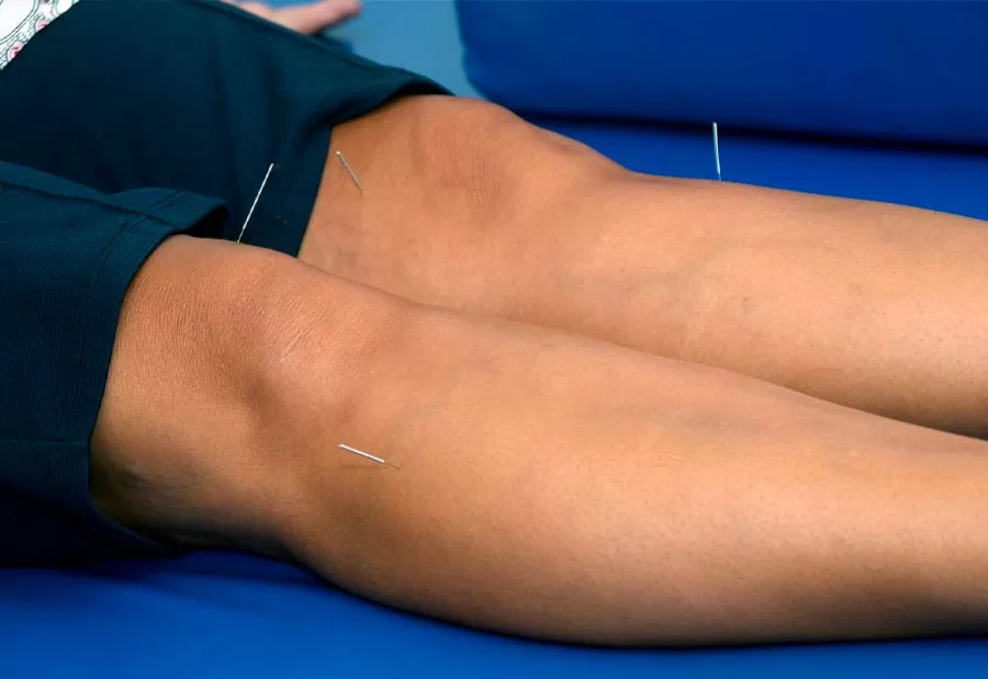 Saiba o que é Auriculoterapia, serviço oferecido pelo CTO em Teixeira de Freitas