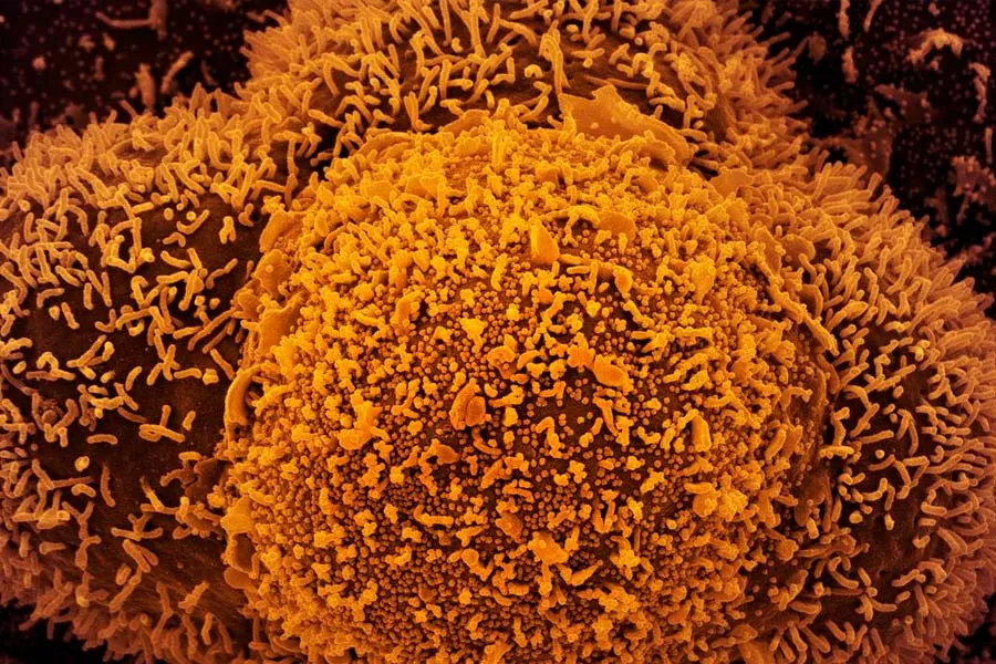 Nova subvariante da covid-19 é identificada em Mato Grosso