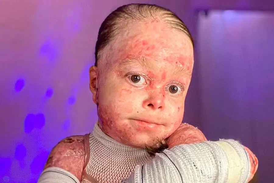 Morre aos 31 anos Dai Cruz, influenciadora digital que tinha doença genética rara Morre aos 31 anos Dai Cruz, influenciadora digital que tinha doença genética rara