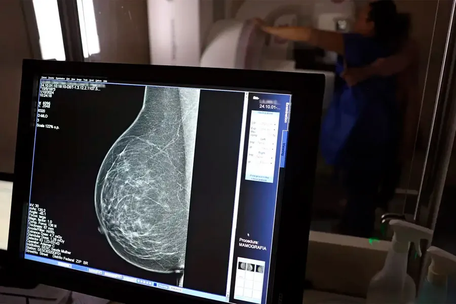 Médicos lançam guia para evitar recusa de mamografia digital