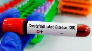 Entenda Doença de Creutzfeldt-Jakob, diagnóstico do piloto Lito Souza