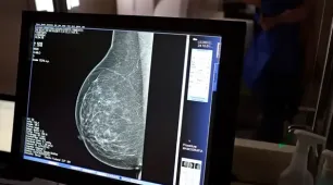 Médicos lançam guia para evitar recusa de mamografia digital