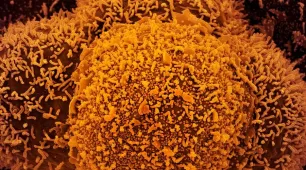 Nova subvariante da covid-19 é identificada em Mato Grosso